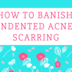 How to Get Rid of Indented Acne Scars Naturally & At Home Without Spending a Ton of Money