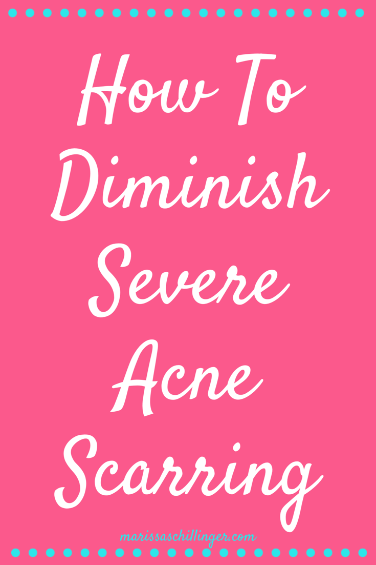 how-to-get-rid-of-indented-acne-scars-naturally-at-home-without